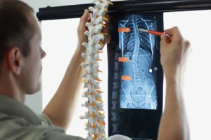 How a Lawyer Can Help You If You’ve Suffered a Spinal Cord Injury